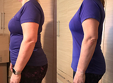 Amanda before and after